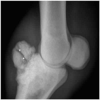 Osteochondroma of the First Phalanx in Tbourida Horses